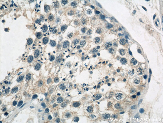 GCNF Antibody in Immunohistochemistry (Paraffin) (IHC (P))