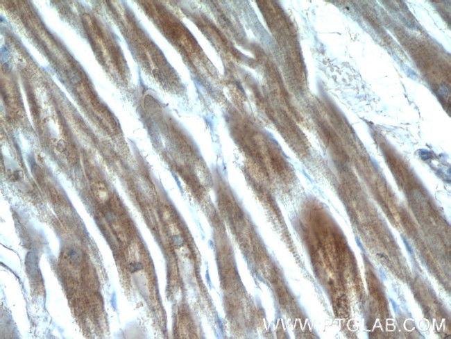 QSOX1 Antibody in Immunohistochemistry (Paraffin) (IHC (P))