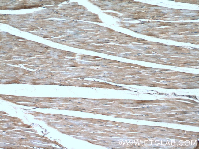 Dystrophin Antibody in Immunohistochemistry (Paraffin) (IHC (P))