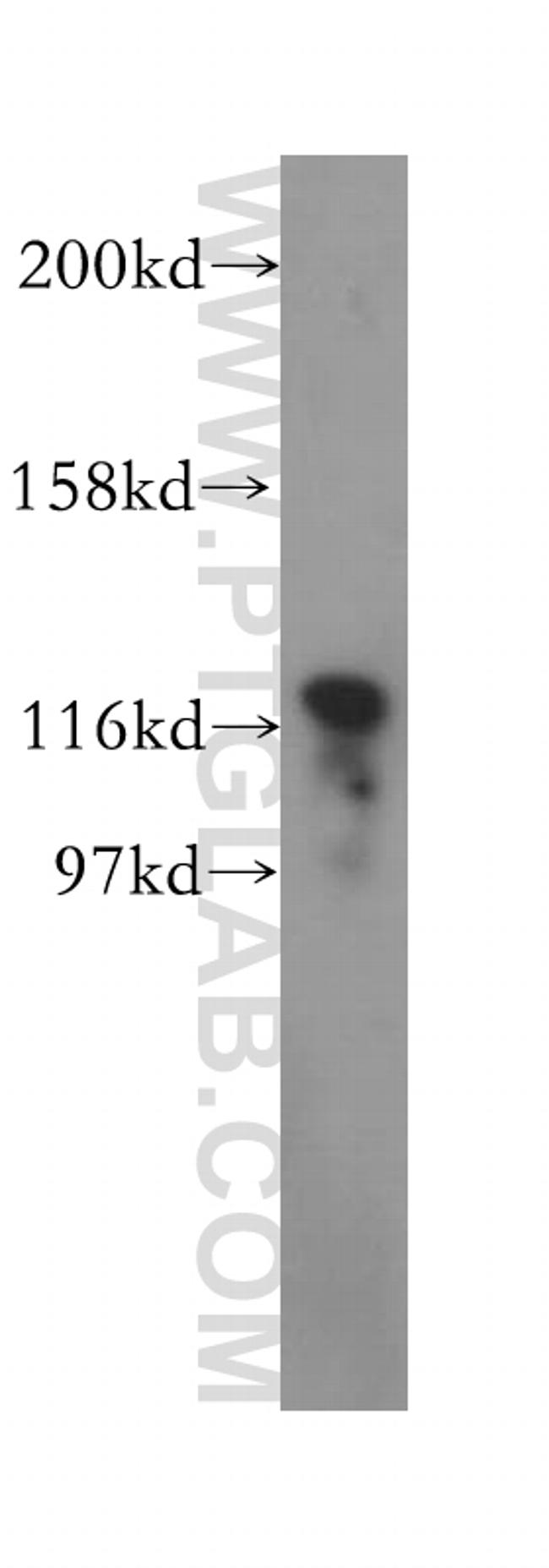 SKIV2L2 Antibody in Western Blot (WB)