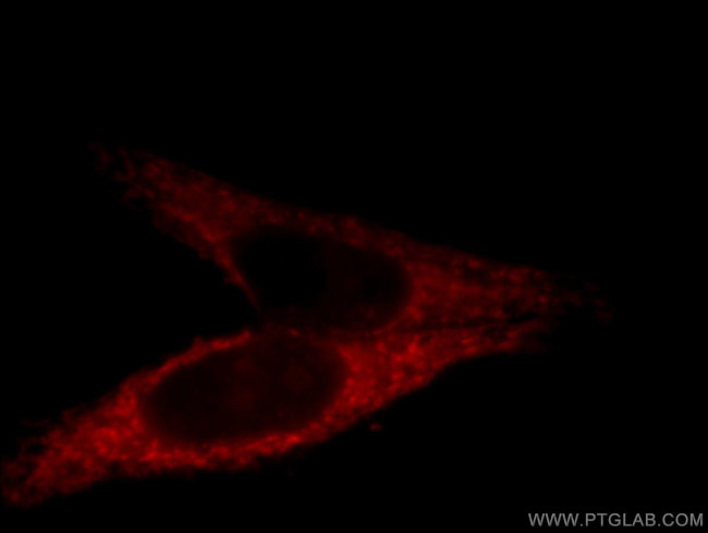 GRPEL1 Antibody in Immunocytochemistry (ICC/IF)