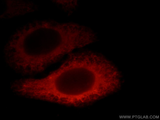 EXOC6 Antibody in Immunocytochemistry (ICC/IF)