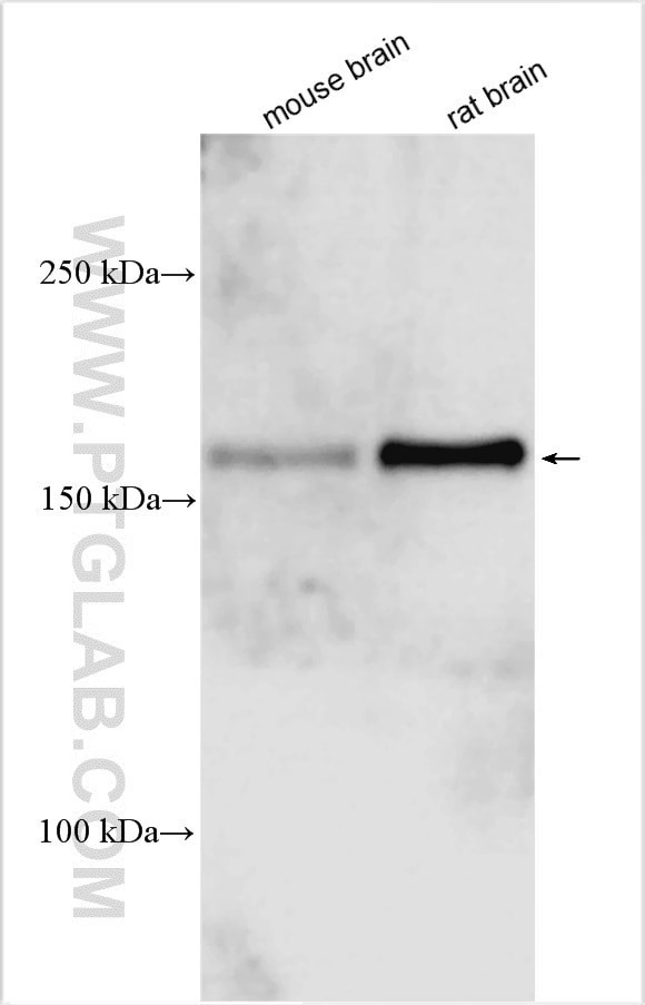 TRPM3 Antibody in Western Blot (WB)