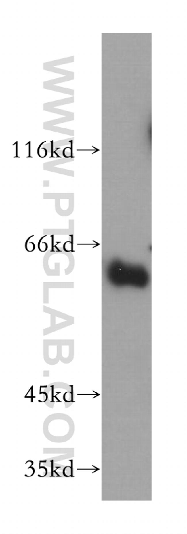 Synaptotagmin-3 Antibody in Western Blot (WB)