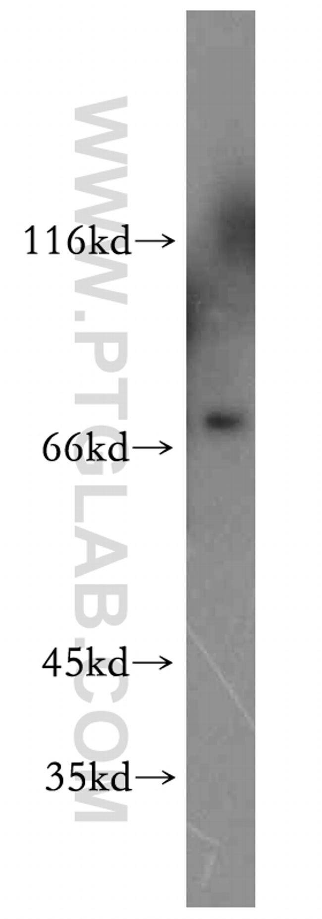 ELL2 Antibody in Western Blot (WB)