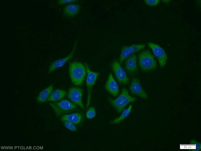 RabGEF1 Antibody in Immunocytochemistry (ICC/IF)