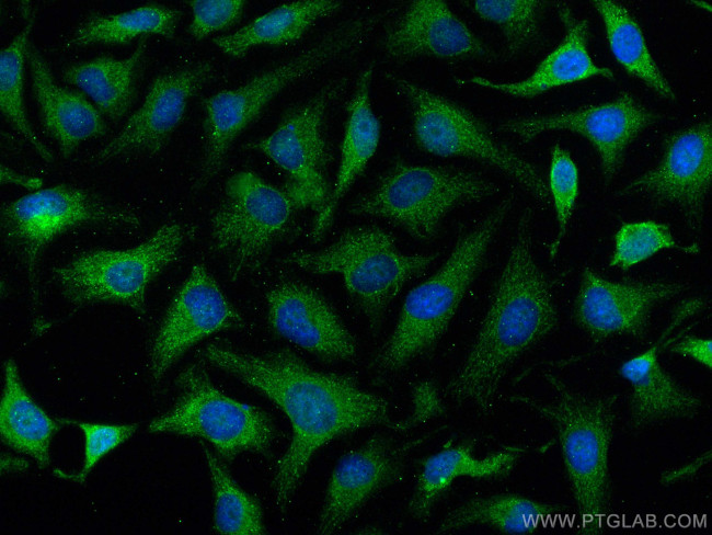 Collagen Type XXV Antibody in Immunocytochemistry (ICC/IF)