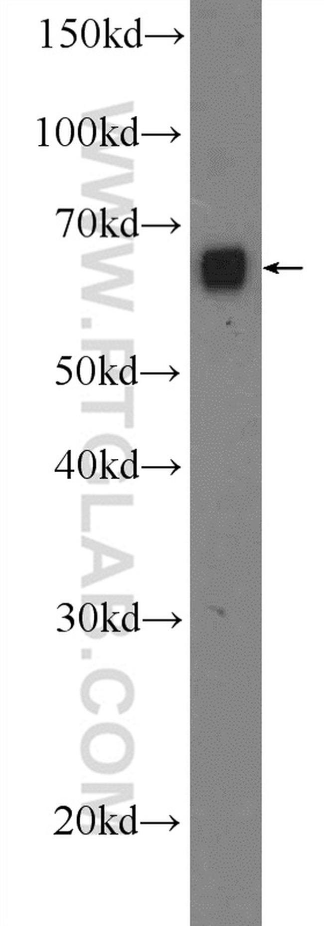 ORC2L Antibody in Western Blot (WB)