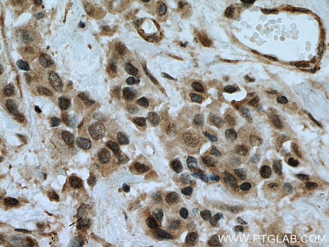 MEK6 Antibody in Immunohistochemistry (Paraffin) (IHC (P))