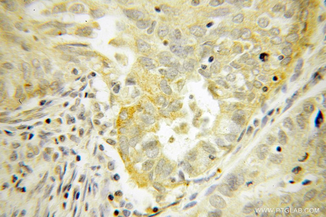 ELP4 Antibody in Immunohistochemistry (Paraffin) (IHC (P))
