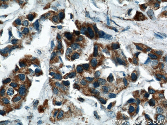 PPP2R2C Antibody in Immunohistochemistry (Paraffin) (IHC (P))