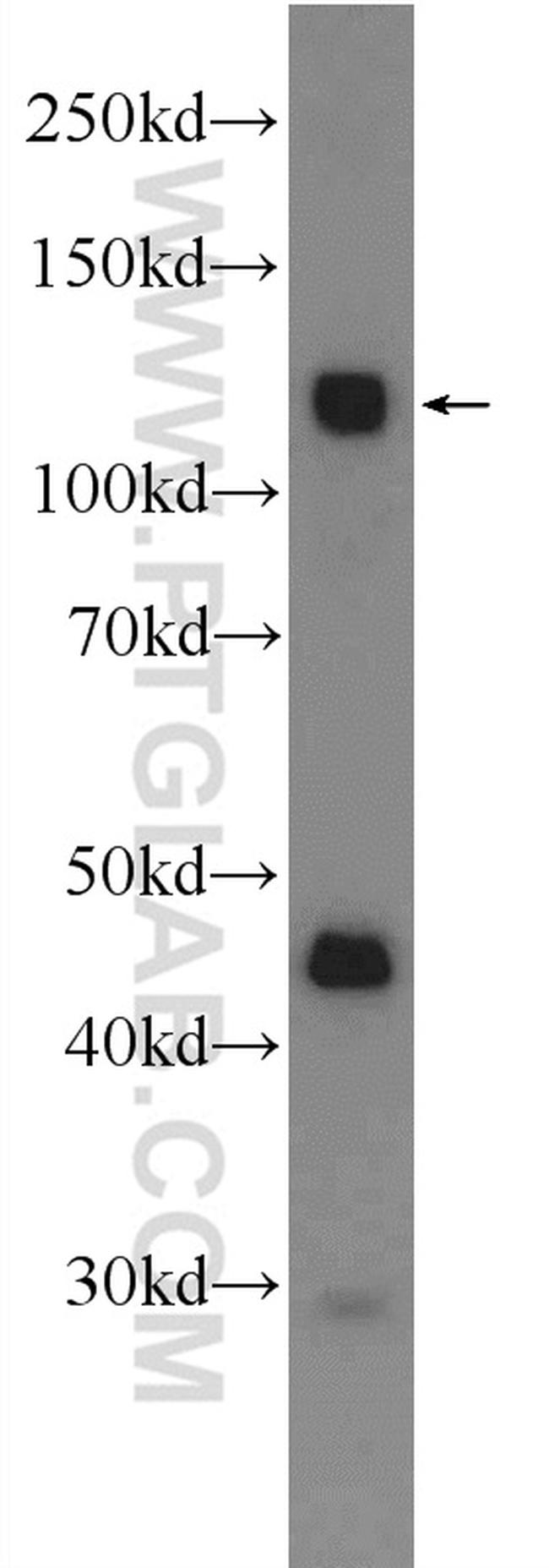 CDCP1 Antibody in Western Blot (WB)