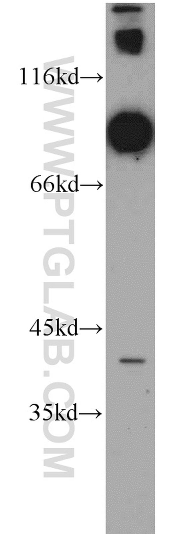DNAI1 Antibody in Western Blot (WB)