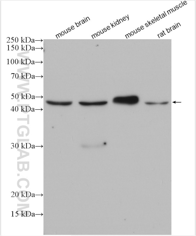 TRIM39 Antibody in Western Blot (WB)