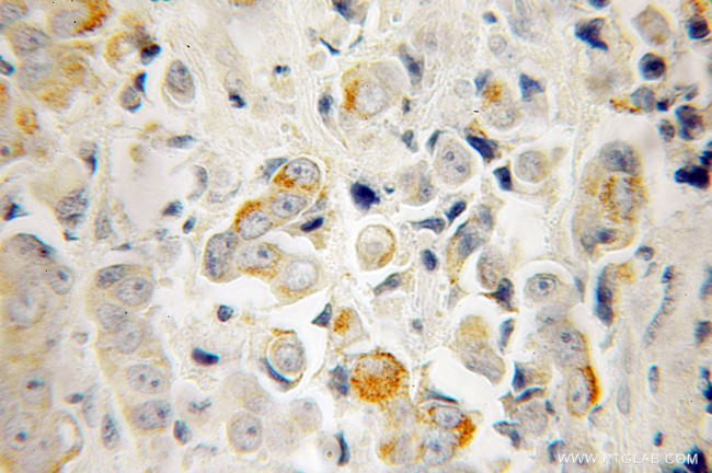 RTKN Antibody in Immunohistochemistry (Paraffin) (IHC (P))