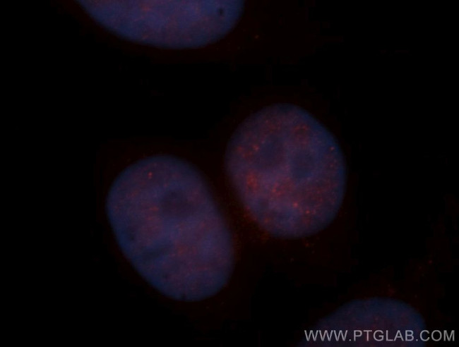 HNRNPD Antibody in Immunocytochemistry (ICC/IF)