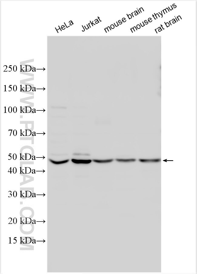 MKRN1 Antibody in Western Blot (WB)
