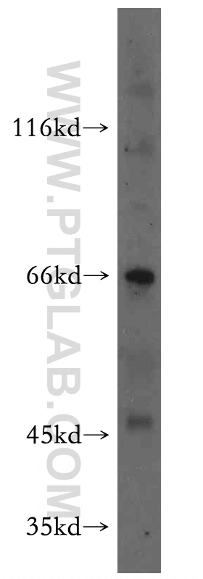 MEIS3 Antibody in Western Blot (WB)