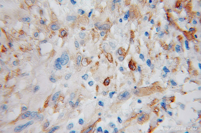 ENPP5 Antibody in Immunohistochemistry (Paraffin) (IHC (P))