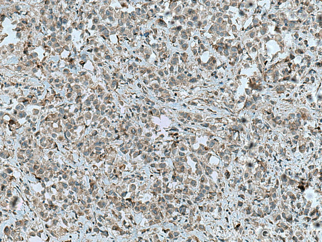PRKD3 Antibody in Immunohistochemistry (Paraffin) (IHC (P))