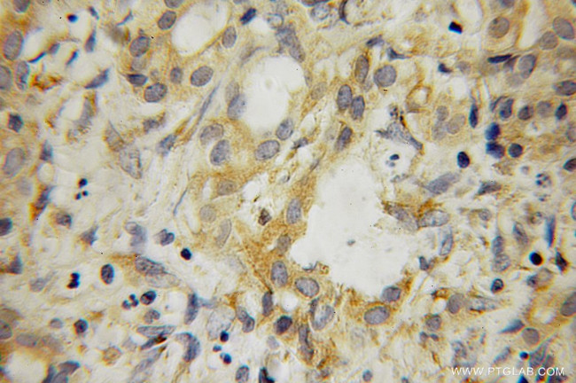 SRFBP1 Antibody in Immunohistochemistry (Paraffin) (IHC (P))