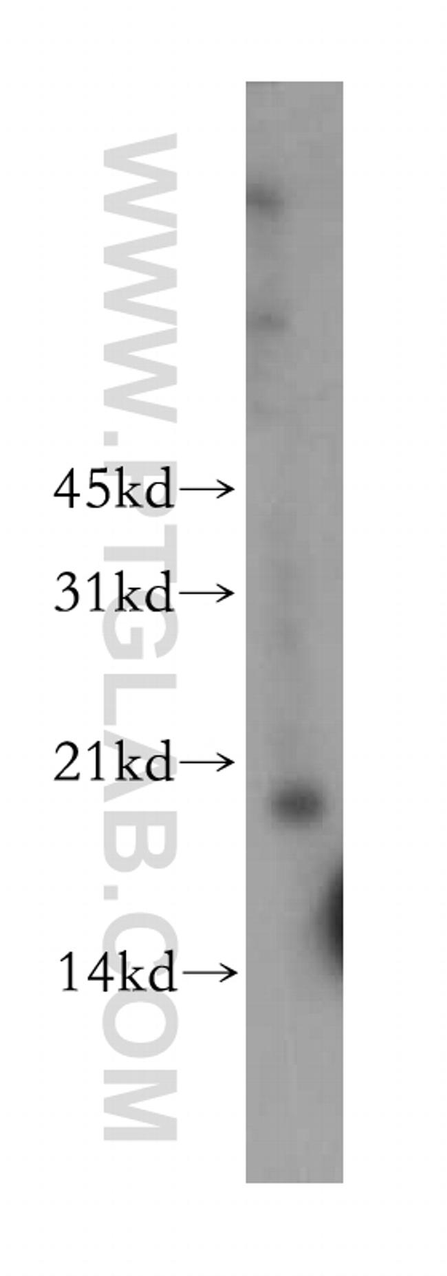 TPRKB Antibody in Western Blot (WB)