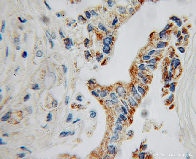 GATM Antibody in Immunohistochemistry (Paraffin) (IHC (P))