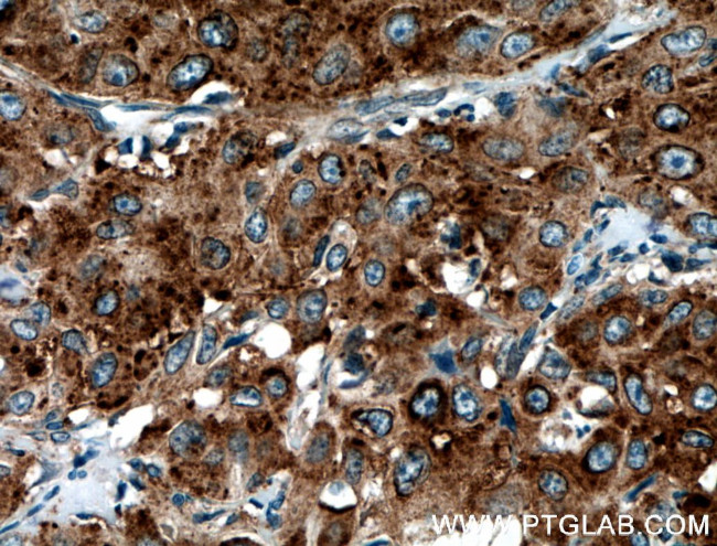 SEPT6 Antibody in Immunohistochemistry (Paraffin) (IHC (P))