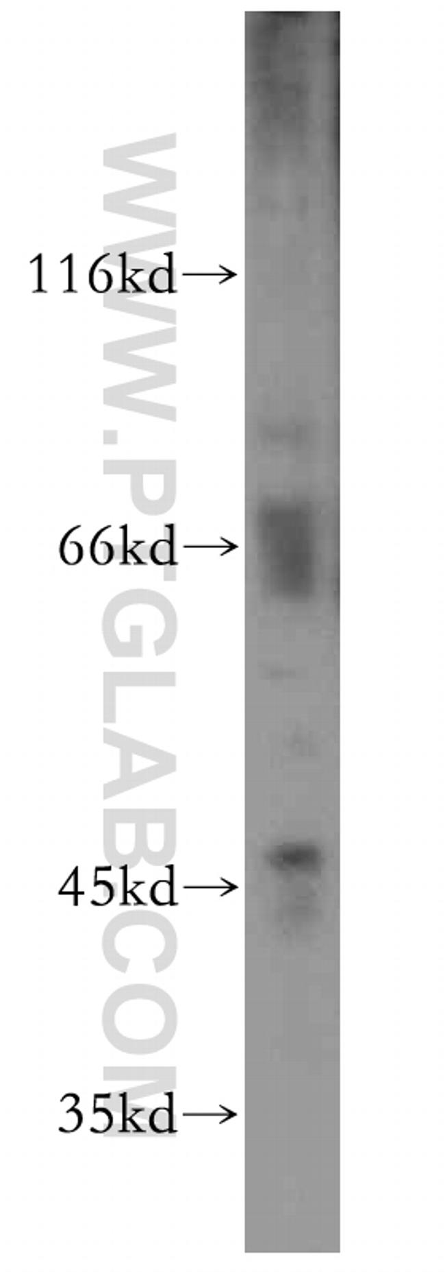 DNAJA4 Antibody in Western Blot (WB)