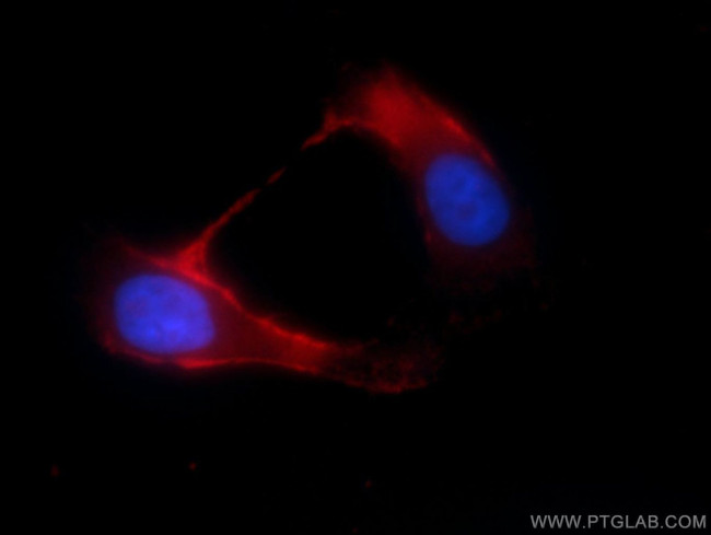 TRPM8 Antibody in Immunocytochemistry (ICC/IF)