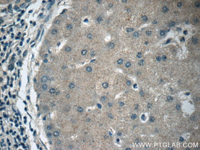 APOM Antibody in Immunohistochemistry (Paraffin) (IHC (P))
