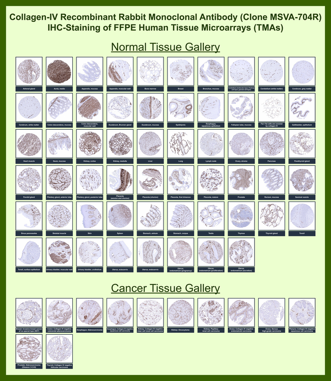 Collagen IV Antibody in Immunohistochemistry (Paraffin) (IHC (P))