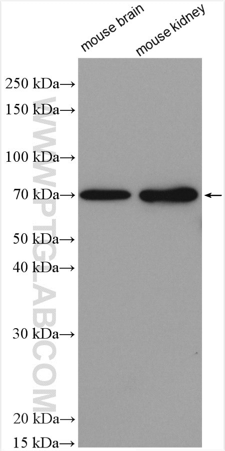 SLC20A2 Antibody in Western Blot (WB)