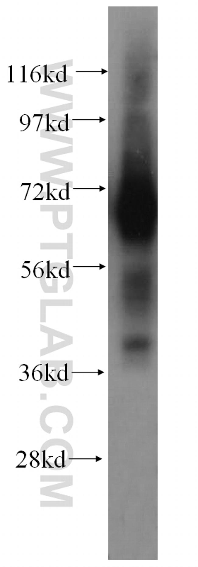 PAPOLB Antibody in Western Blot (WB)