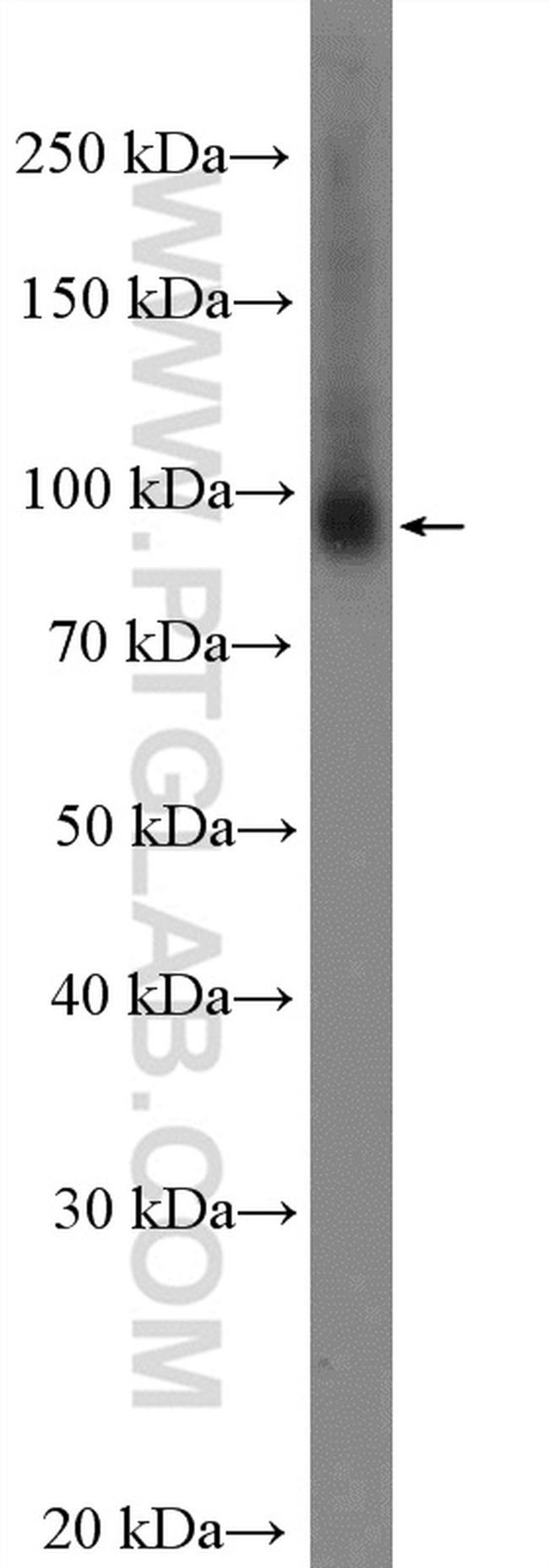 VPS53 Antibody in Western Blot (WB)
