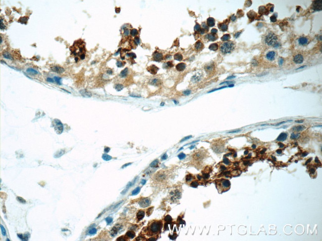 SPACA1 Antibody in Immunohistochemistry (Paraffin) (IHC (P))