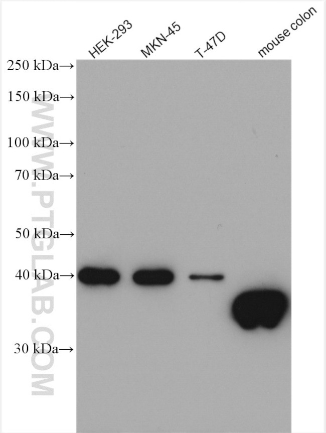 GIPC2 Antibody in Western Blot (WB)