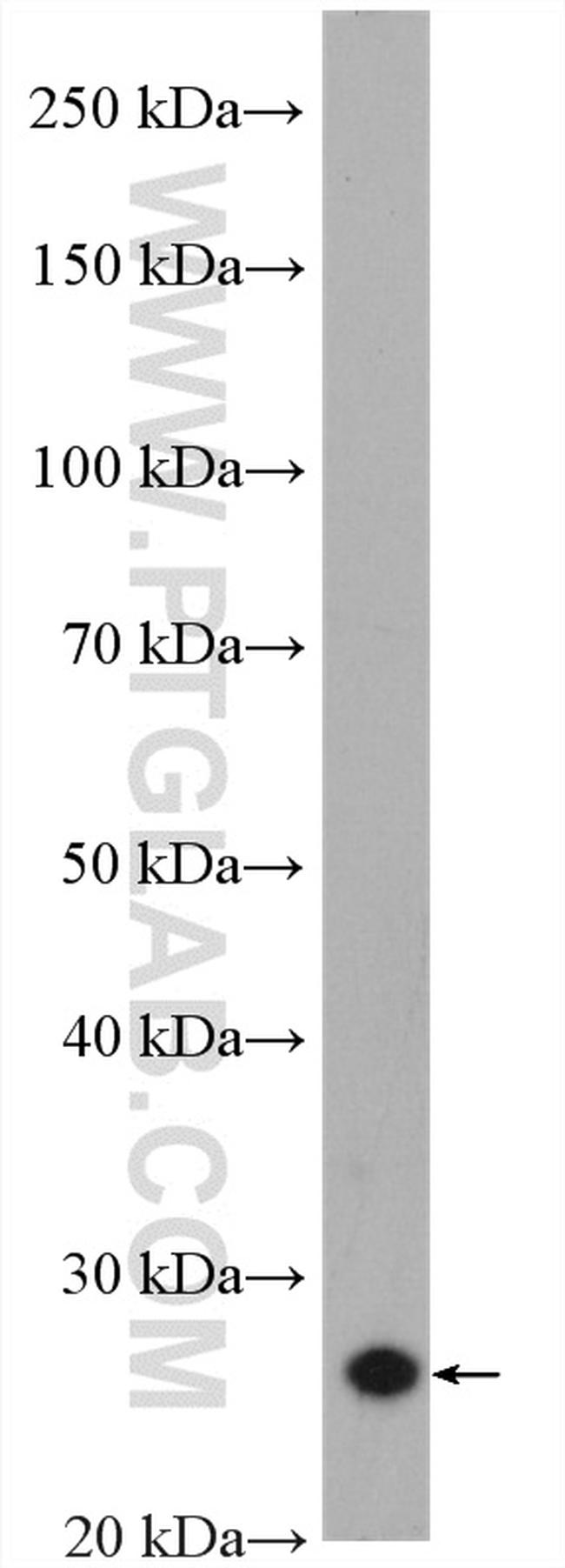 CENPH Antibody in Western Blot (WB)