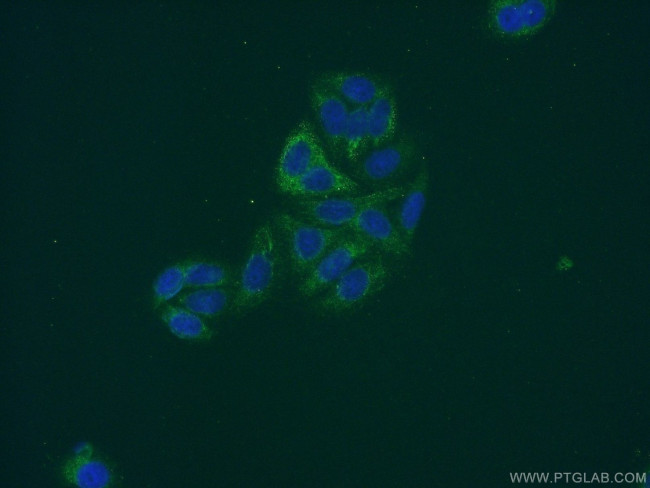 FBXO17 Antibody in Immunocytochemistry (ICC/IF)
