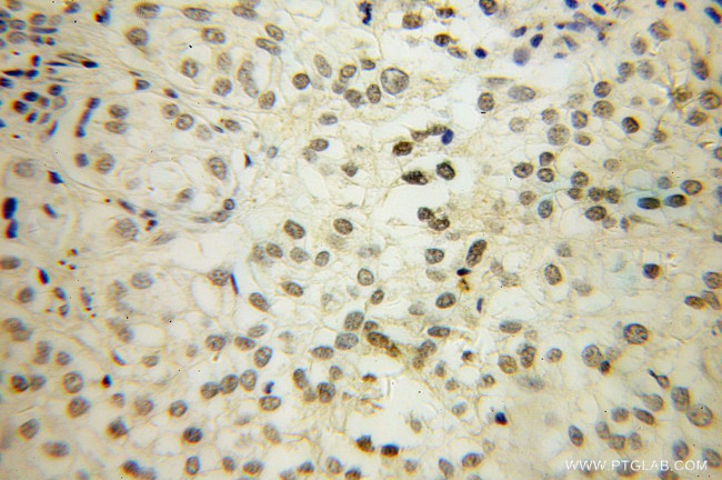 HS1BP3 Antibody in Immunohistochemistry (Paraffin) (IHC (P))