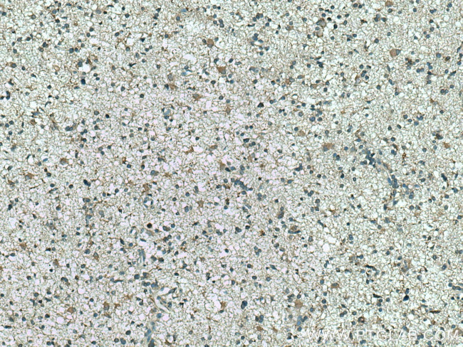 CMIP Antibody in Immunohistochemistry (Paraffin) (IHC (P))