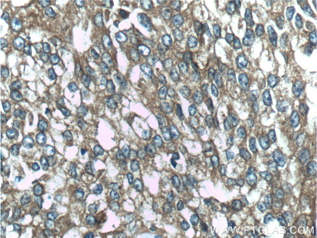 CTPS2 Antibody in Immunohistochemistry (Paraffin) (IHC (P))
