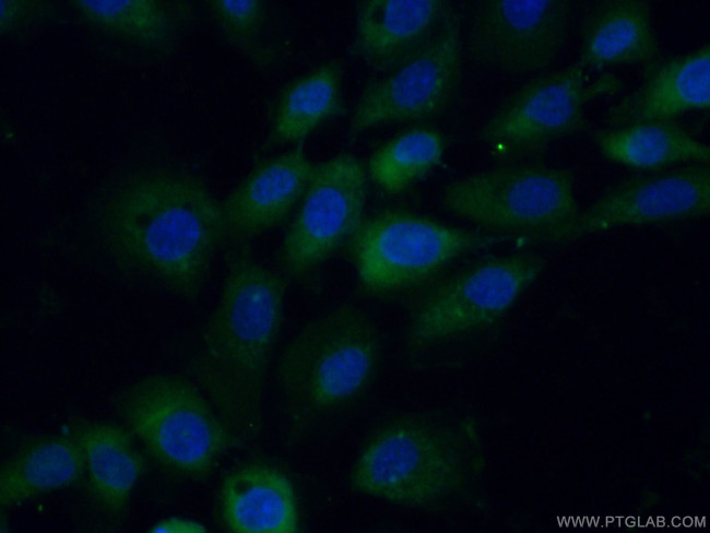STK33 Antibody in Immunocytochemistry (ICC/IF)
