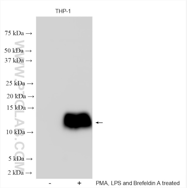 CCL3L1 Antibody in Western Blot (WB)