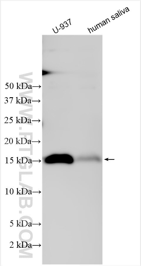 ALOX5AP Antibody in Western Blot (WB)