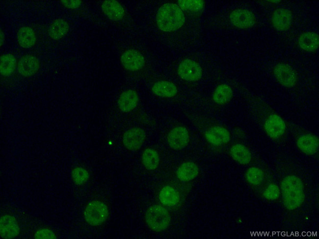 PHC2 Antibody in Immunocytochemistry (ICC/IF)