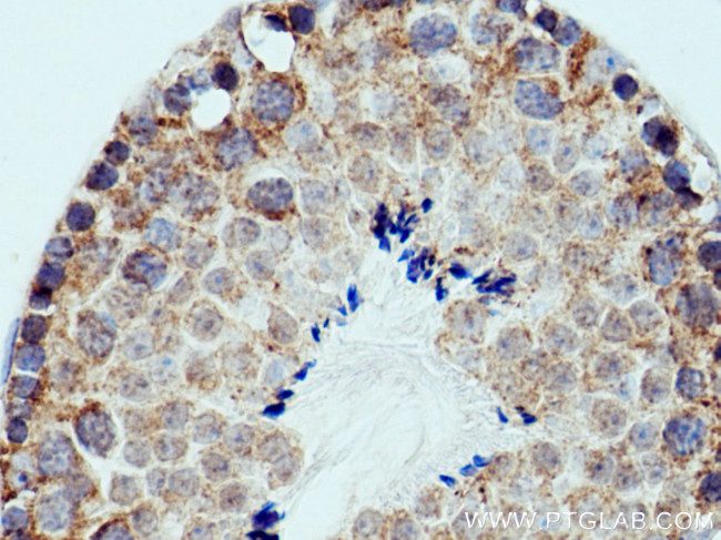 PPEF1 Antibody in Immunohistochemistry (Paraffin) (IHC (P))