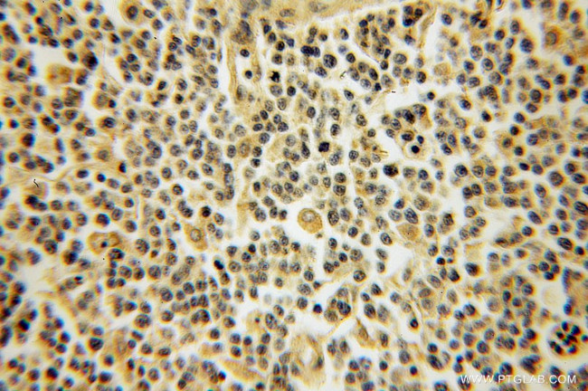 DYRK4 Antibody in Immunohistochemistry (Paraffin) (IHC (P))