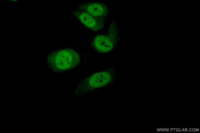 TDP-43 (C-terminal) Antibody in Immunocytochemistry (ICC/IF)