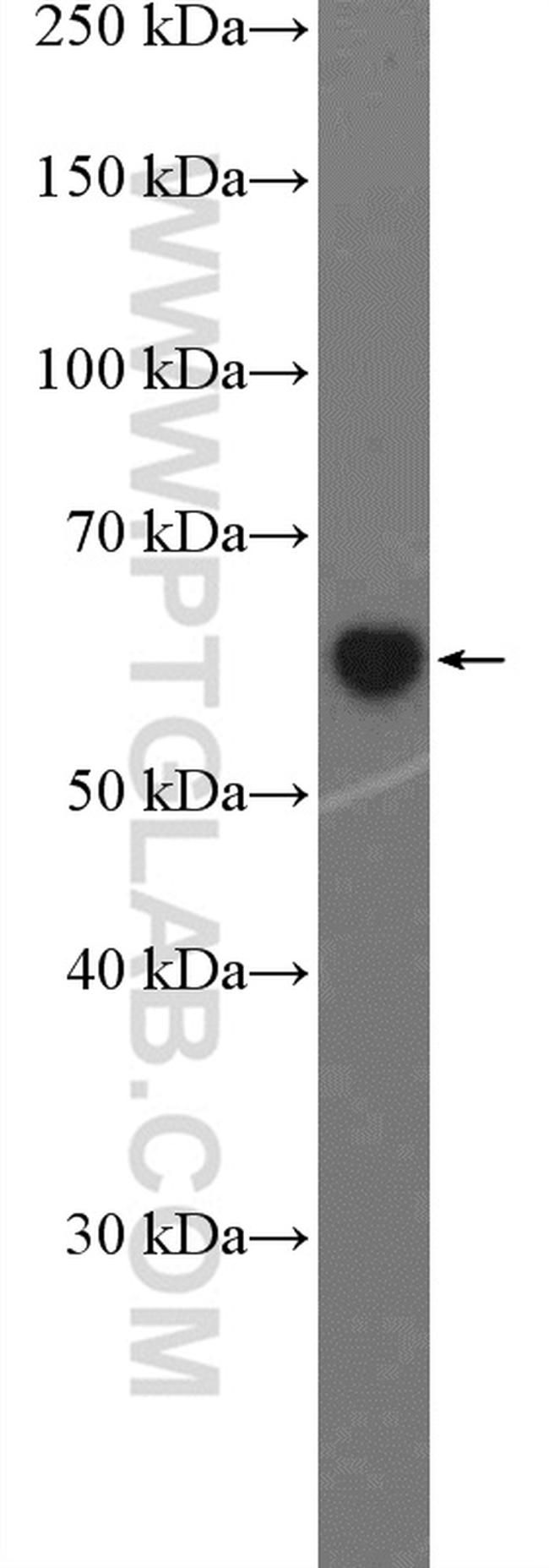 SLAMF7 Antibody in Western Blot (WB)